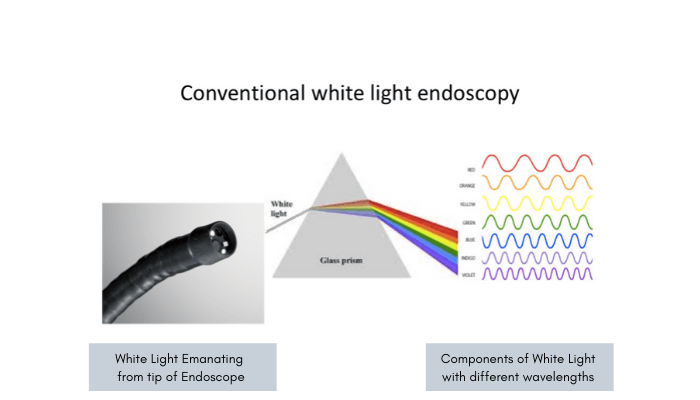 Conventional White Light Endoscopy
