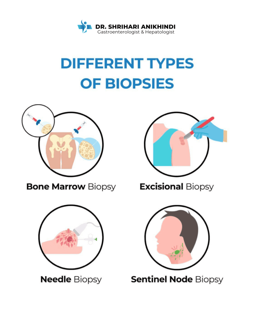 Upper Gastrointestinal Subepithelial Lesions